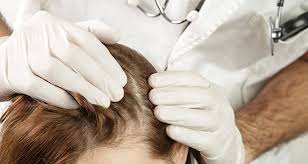 Natural Shampoos for Sensitive Scalps, Best Shampoo for Sensitive Scalps, seboorheic dermatitis shampoo