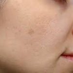 best cream for sun damaged skin, sun damage on face, snail cream foe sun damaged skin,