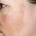 beast cream for sun damaged dkin,sun damage on face, sun damaged skin cream, snail cream for sun damaged skin,