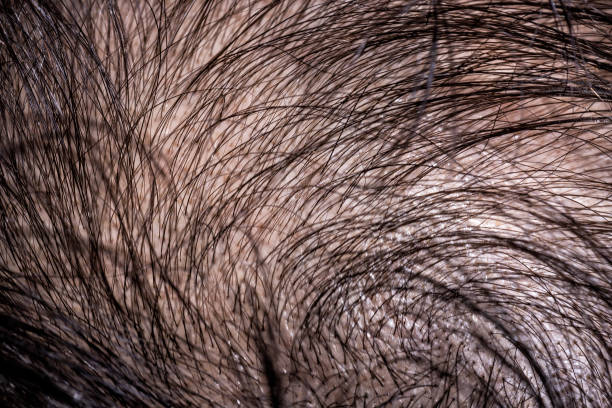 shampoo for thinning hair,