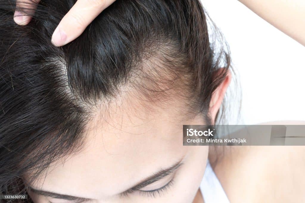 shampoo for thinning hair,