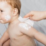 eczemA cream,dermatitis in infants, infant eczema cream