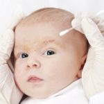 Best Atopic Dermatitis Creams,