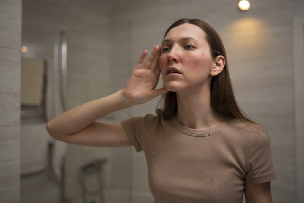 perioral dermatitis, skin rash around mouth, facial rash treatment Ireland, perioral dermatitis causes, gentle skin care for rash, perorial dermatitis nose