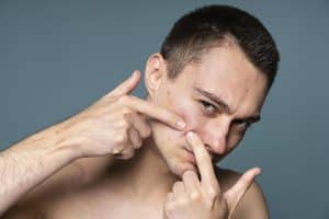 is snail mucin good for acne,