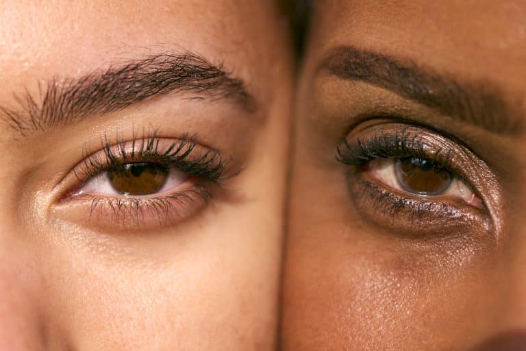 Best Eye Creams for Eczema on Eyelids: Soothe irritation fast with gentle formulas featuring snail mucin. Perfect for sensitive, dry, or eczema-prone skin., Relief for Eczema on Eyelid