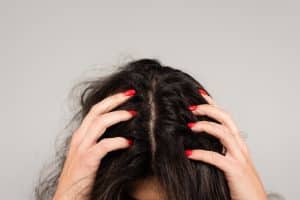 Treatments for Scalp