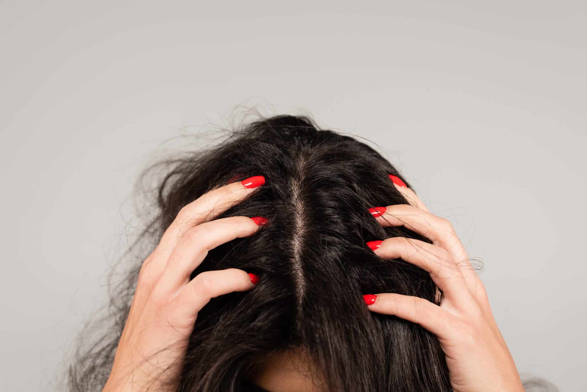 Treatments for Scalp
