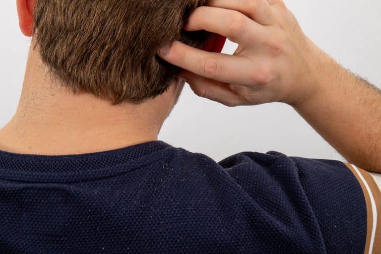 Best shampoo for scalp psoriasis, ​sebhorrheic dermatitis shampoo, best shampoo for seborrheic dermatitis, natural treatment for seborrheic dermatitis, seborrheic dermatitis scalp care, anti-dandruff shampoo for seborrheic dermatitis, seborrheic dermatitis scalp treatment, treat seborheic dermatitis, Gentle shampoo for sensitive scalp., fragrance free shampoo, ​cream for eczema itching, eczema cream for sensitive skin, best cream for itchy eczema, natural treatment for eczema, soothing cream for eczema relief