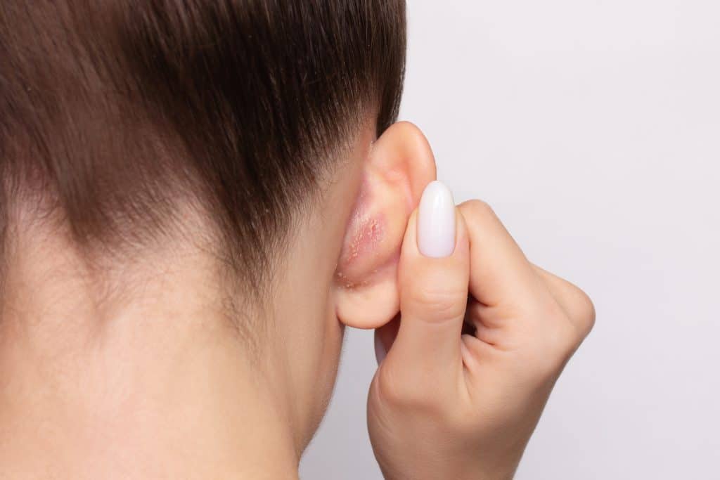 ​Eczema Behind Ears, itchy skin behind ears, eczema treatment Ireland, dry skin behind ears, soothing eczema rash, eczema relief tips, ​eczema behind ears, eczema treatment Ireland, itchy ears eczema, causes of eczema behind ears, eczema remedies for sensitive skin