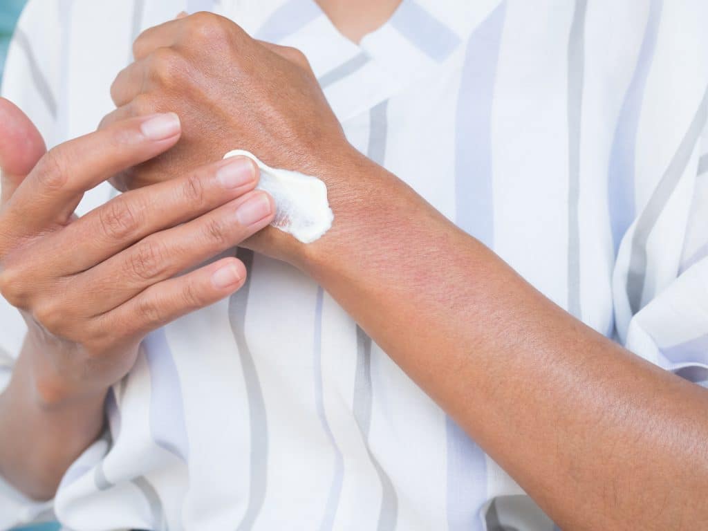 ​psoriasis treatment cream, best psoriasis cream, psoriasis ointment Ireland, natural psoriasis treatment, psoriasis relief cream, a good cream for psoriasis, Treatment for Eczema
