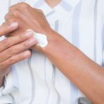 Elbow with eczema — applying moisturiser