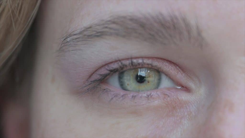 close-up of mild redness on upper eyelid from eczema