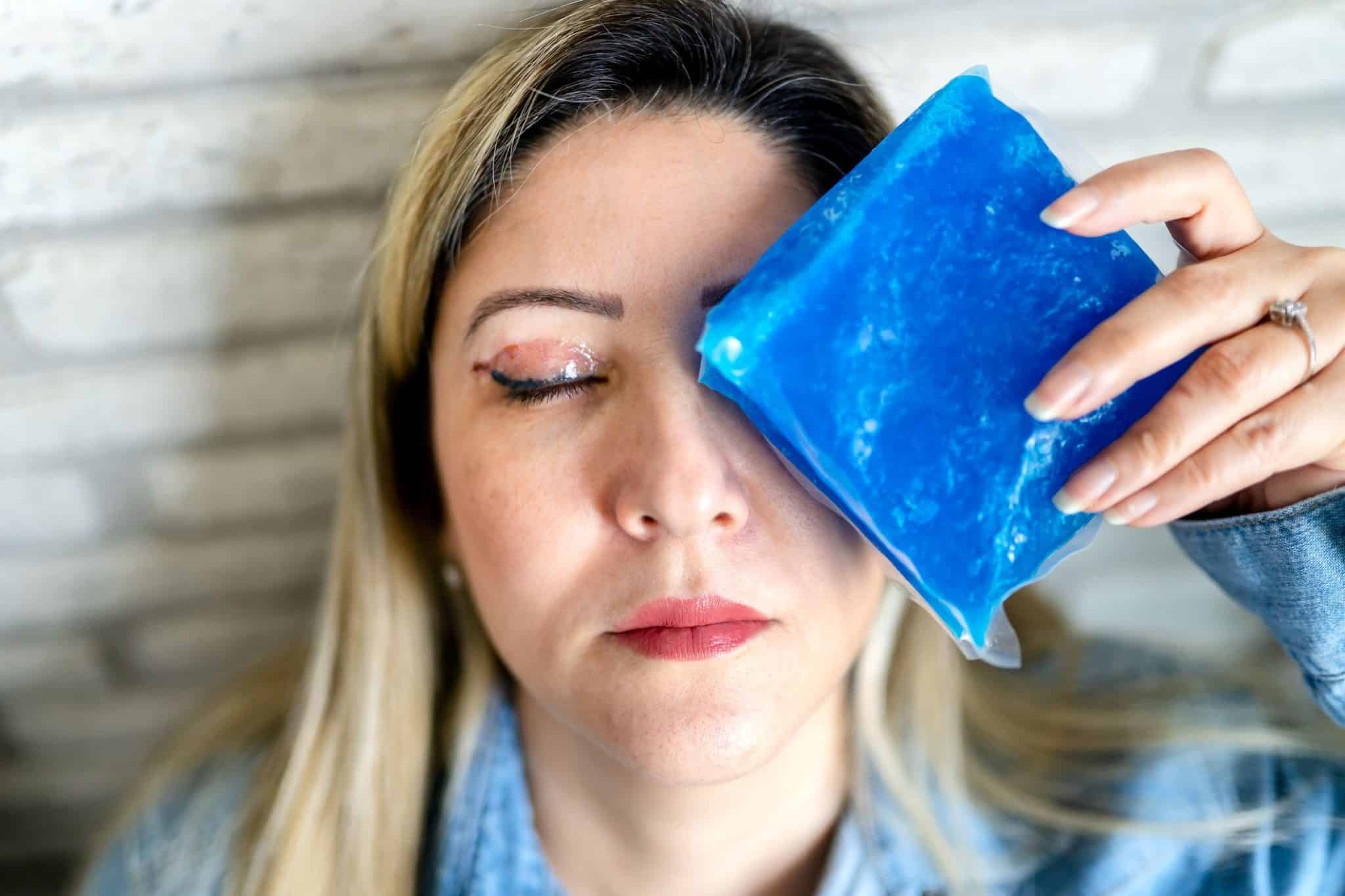 best eye cream for eczema on eyelids, Natural Eyelid Eczema Cream, ​eyelid eczema, eczema treatment, skin care for eczema, allergic reactions on eyelids, eczema symptoms and causes