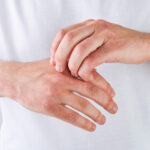 psoriasis and joint pain on hands,