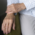 Living with psoriatic arthritis and sensitive skin during flare-ups