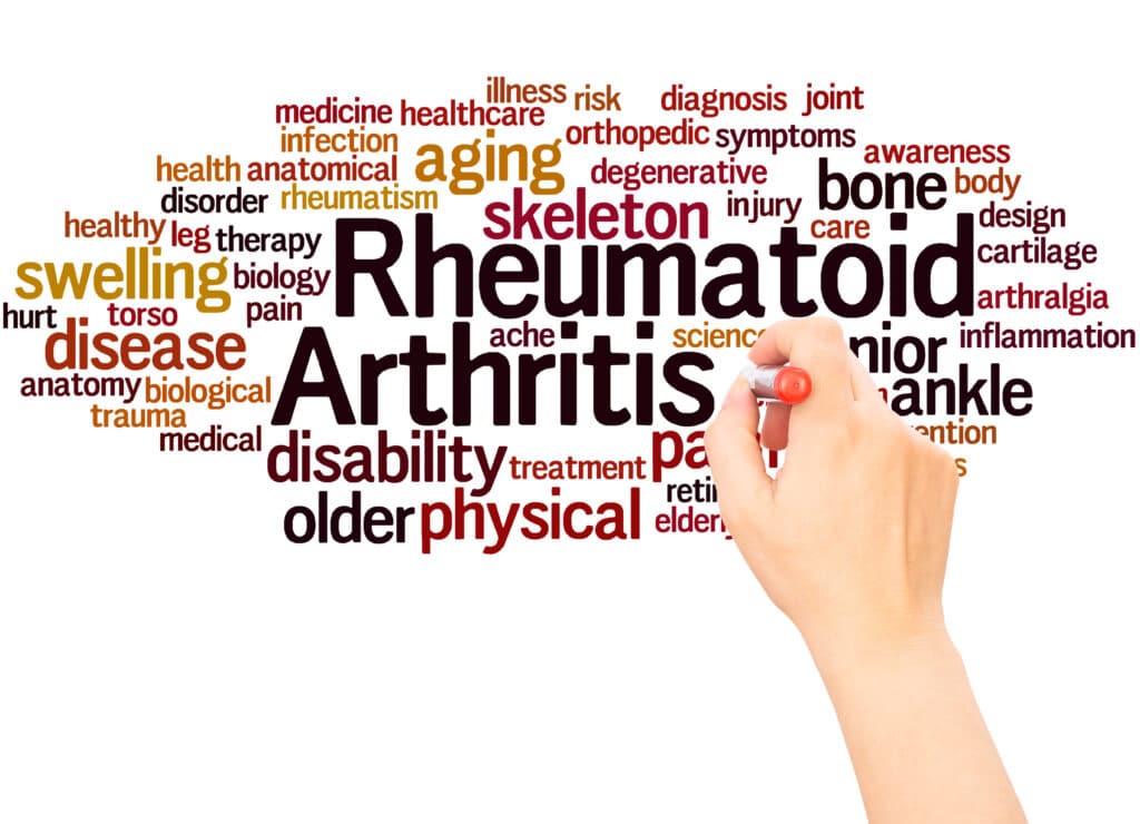 Psoriatic Arthritis vs Rheumatoid Arthritis