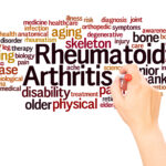 Psoriatic Arthritis vs Rheumatoid Arthritis