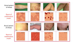 private-area-rash-types-dermatitis-vs-fungal.jpg