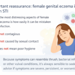 infographic about reassurance on female genital eczema