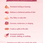symptoms of vulval eczema