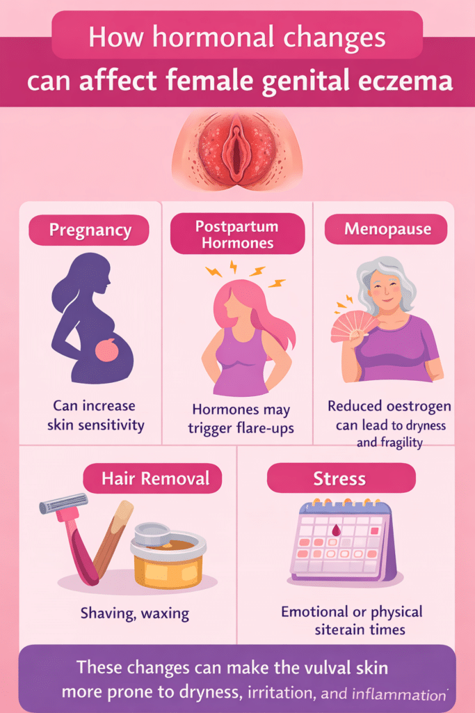 Infographic on how hormones affect female genital eczema.