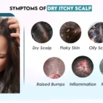 symptoms of an itchy graphic