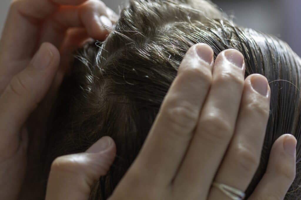 a mother examines her daughter's sensitive scalp
