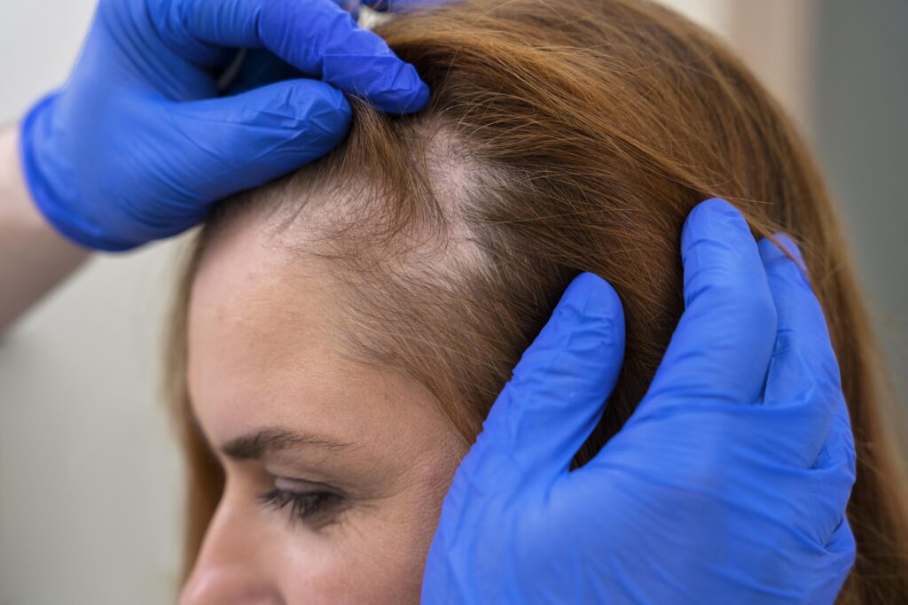woman having scalp eczema examined.